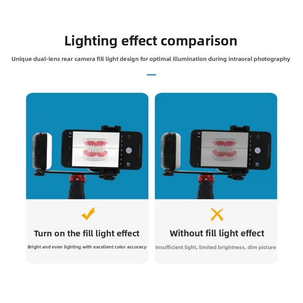 Lumière de photographie dentai - Lighting Gallery avis et prix
